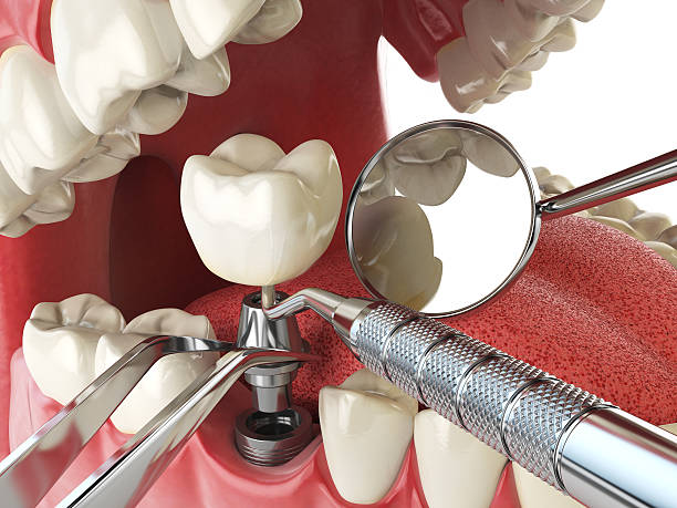 Best Tooth Infection Emergency Dentist  in Haworth, NJ
